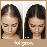 Foligrow™ GrowthPro Kit